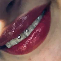 خدمات پرسینگ غرب تهران