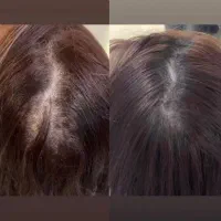 پرپشتی رو به خودت هدیه بده