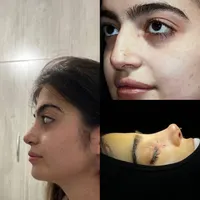 عمل بینی فقط۱۷ کلینیک +جراحی +بیهوشی|خدمات آرایشگری و زیبایی|تهران, زعفرانیه|دیوار