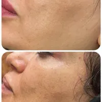 مطب زیبایی دکتر هما خاکزاد|خدمات آرایشگری و زیبایی|مشهد, گوهرشاد|دیوار