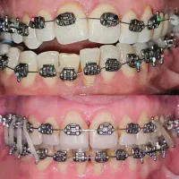 ارتودنسی با شرایط ویژه