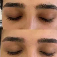 هیرتراپیست