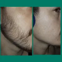 رخ بهتر اعتماد به نفس بالا تر