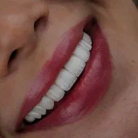 کامپوزیت تمام اقساط