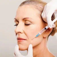 مدل تزریق ژل و نخ لیفت