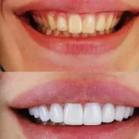 کلیه خدمات دندانپزشکی