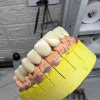 لابراتوار دندانسازی (بخش ثابت) دندانپزشکی