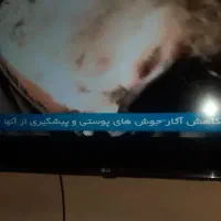 تلوزیون LG 43 LED SMART ال ای دی ال جی ۴۳