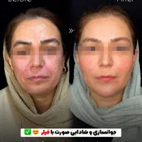 تخفیف تخفیف تخفیف ۳۰ درصدی خدمات زیبایی