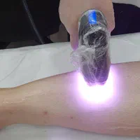 آخرین جشنواره پاییزه لیزرتضمینی موهای زائد