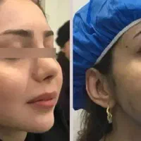 کلینیک پیکرتراشی لیپو،ابدو،پروتز،مامو،تزریق چربی