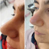 آف محرم پاکسازی و فشیال پوست و اموزش