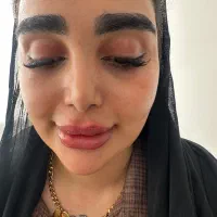 ژل لب رایگان زاویه سازی گونه چونه امروز فوری