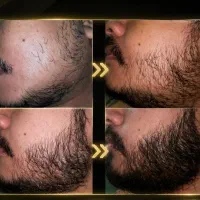 اولین و بهترین روش