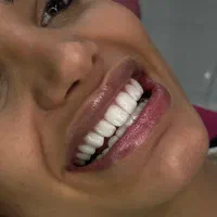 تخفیف ویژه کامپوزیت فقط ۸ میلیون