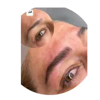 میکرو بلیدینگ و شیدینگ لب