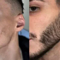 اعتماد از تو ریش از ما