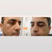 کرم معجزه‌آور بیوممتیک گاتیو تحویل یک‌روزه