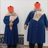 کاهش وزن و چاقی و چاقی صورت