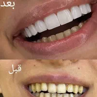 کامپوزیت انگلیسی  ضمانتی تخفیف ویژه (فقط۱۰)