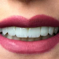 خدمات دندانپزشکی دیجیتال در کلینیک دندانپزشکی هلما