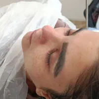 خدمات پاکسازی و جوانسازی پوست