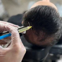 دعوت ب همکاری پزشک عمومی/اپراتورلیزر/فیشال