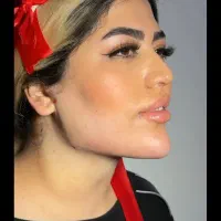 مدل خانم بسیار خوش چهره زیر سال ۳۵ برای ساکشن غبغب
