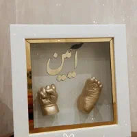 قالبگیری دست ث پا