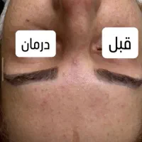 فشیال تخصصی