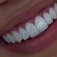 دندانپزشکی درمانی و زیبایی تعرفه قبل از افزایش