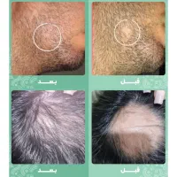 اتمام ریزش سکه ایی