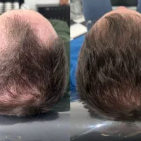 وقتشه با موهات استایل بزنی