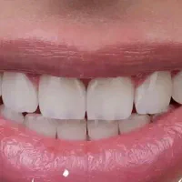 دستیار حرفه ای دندانپزشکی
