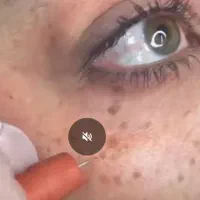 پاک سازی پوست