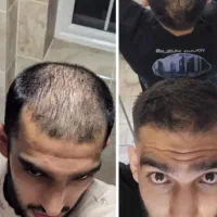 پرپشت تر از همیشه