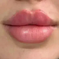 ژل لب