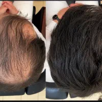 موهات مثل چمن درمیاد