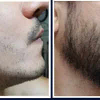 معجزه رویش مو و ریش
