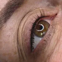 ارایش دائم تاتورژلب ابروبن مژه خط چشم فیبروز ریموو