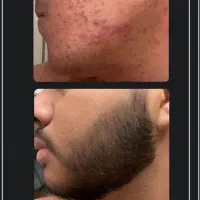 ریش یکدست وپر پشت