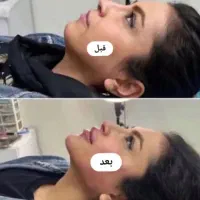 بوتاکس.فیلربادی.واژینوپلاستی.ژل لب.لابیاپلاستی