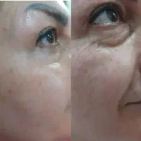 ضدآفتاب وضدلک
