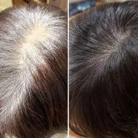 کمک میکنم از افسردگی در بیای