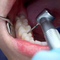 تخفیف جشنواره عیدانه کلینیک تخصصی دندانپزشکی کوثر
