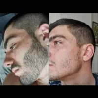 ضمانت ۳۰ روزه ای با من