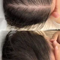 خسته شو از موهای کمت