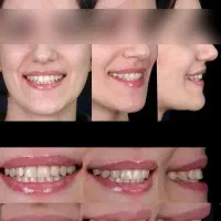 ارتودنسی توسط متخصص اقساطی بدون چک مشاوره رایگان
