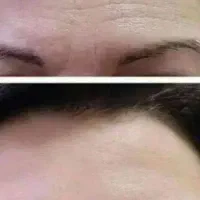 روغن برای چین و چرک