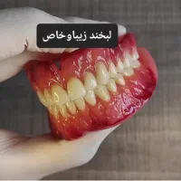 ساخت دندان مصنوعی جنس سبک وراحت وبدون کام